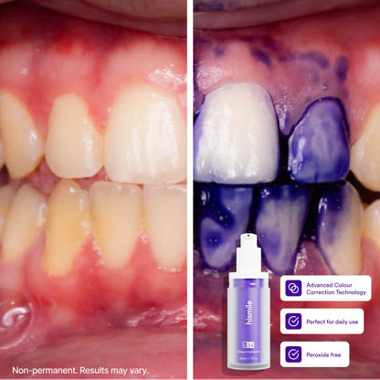 [Recommended by Kim Kardashian] Hismile V34 Colour Corrector - Tooth Stain Concealer, Temporary Brightening Booster, Purple Toothpaste, Colour Correcting
